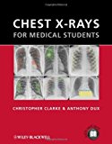 Chest X-rays for Medical Students by Christopher Clarke (4-Nov-2011) Paperback