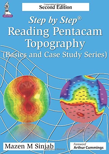 Step by Step: Reading Pentacam Topography: (Basic and Case Study Series) by Mazen M. Sinjab (31-Jan-2015) Paperback