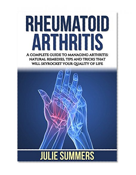 Rheumatoid Arthritis: A complete guide to managing arthritis: natural remedies, tips and tricks that will skyrocket your quality of life