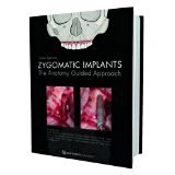 Zygomatic Implants: The Anatomy-Guided Approach [HARDCOVER] [2012] [By Carlos Aparicio]