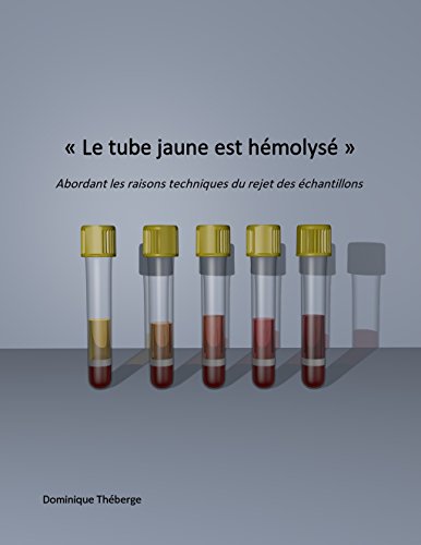 « Le tube jaune est hémolysé »: Abordant les raisons techniques du rejet des échantillons. (French Edition)