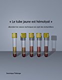 « Le tube jaune est hémolysé »: Abordant les raisons techniques du rejet des échantillons. (French Edition)