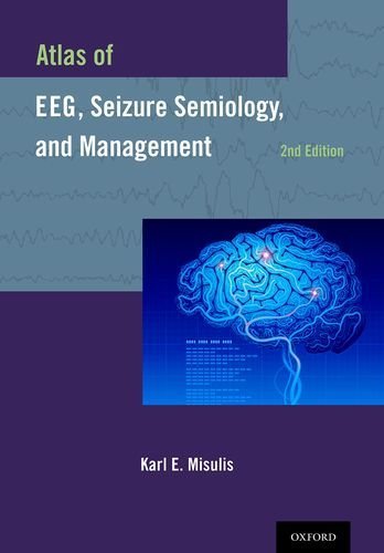Atlas of EEG, Seizure Semiology, and Management by Karl E. Misulis (2013-10-16)
