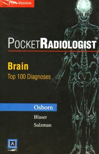 Pocket Radiologist Brain: Top 100 Diagnosis PDA by Anne Osborne (2001-12-10)