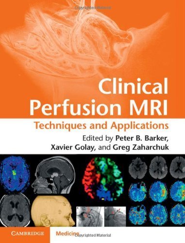Clinical Perfusion MRI: Techniques and Applications (2013-06-28)