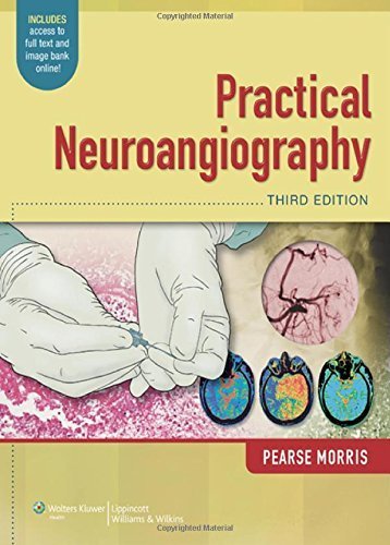 Practical Neuroangiography by P. Pearse Morris MB BCh (2013-02-06)