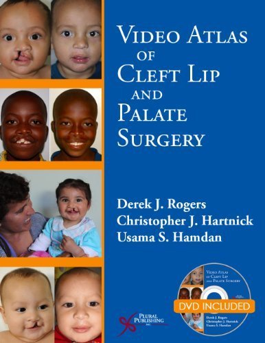 Video Atlas of Cleft Lip and Palate Surgery by Derek Rogers (2013-08-15)