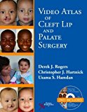 Video Atlas of Cleft Lip and Palate Surgery by Derek Rogers (2013-08-15)
