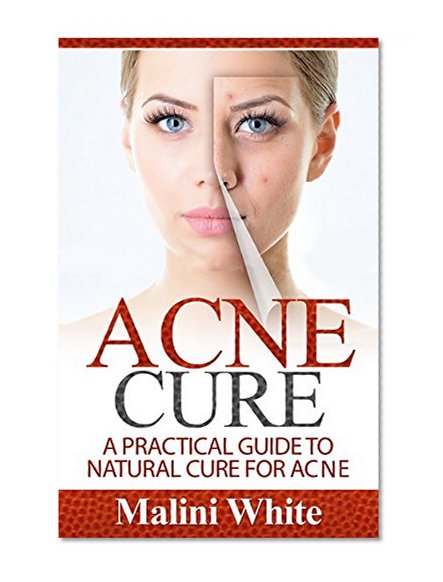 Acne Cure: A Practical Guide to Natural Cure for Acne : Through Herbs, Salves, Essential Oils and Other Natural Remedies