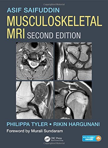 Musculoskeletal MRI, Second Edition by Asif Saifuddin (2016-04-15)