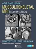 Musculoskeletal MRI, Second Edition by Asif Saifuddin (2016-04-15)