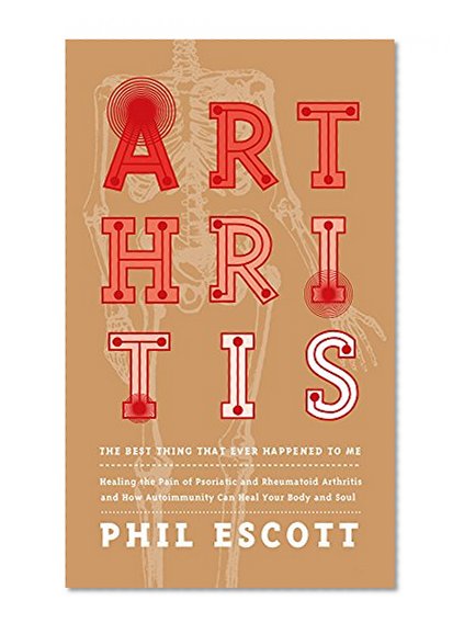 ARTHRITIS - The Best Thing That Ever Happened to Me.: Healing The Pain Of Psoriatic And Rheumatoid Arthritis And How Autoimmunity Can Heal Your Body And Soul