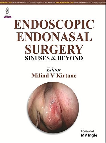 Functional Endoscopic Sinus Surgery by Mv Kirtane (2014-11-30)