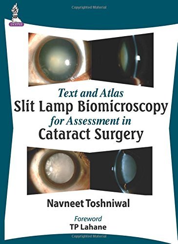 Text and Atlas: Slit Lamp Biomicroscopy for Assessment in Cataract Surgery by Navneet Toshniwal (2014-11-30)