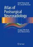 Atlas of Postsurgical Neuroradiology: Imaging of the Brain, Spine, Head, and Neck by Daniel Thomas Ginat (2012-10-23)