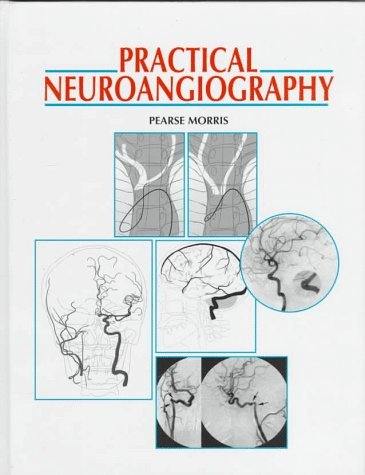 Practical Neuroangiography by Pearse Morris (1997-01-15)