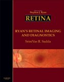 Ryan's Retinal Imaging and Diagnostics, 1e by Stephen J. Ryan MD (2013-09-12)
