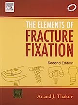 Elements of Fracture Fixation, 2e by Anand J. Thakur MS(Ortho) FCPS Dortho (2010-11-05)