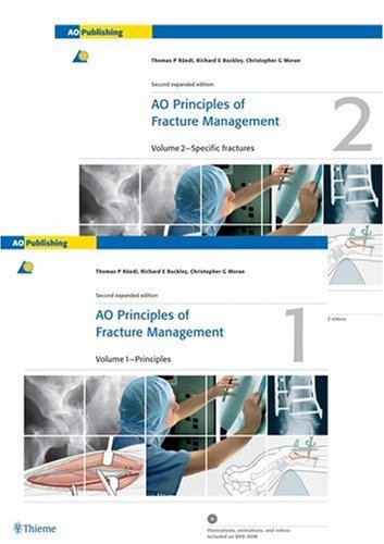 AO Principles of Fracture Management by Thomas P. Ruedi,Thomas Ruedi,Thomas P. (EDT) Ruedi,Richard (EDT) Buckley Richard Buckley (2007-12-24)