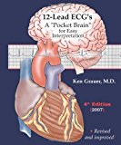12-Lead ECG's: A Pocket Brain for Easy Interpretation by Ken Grauer (2005-12-27)