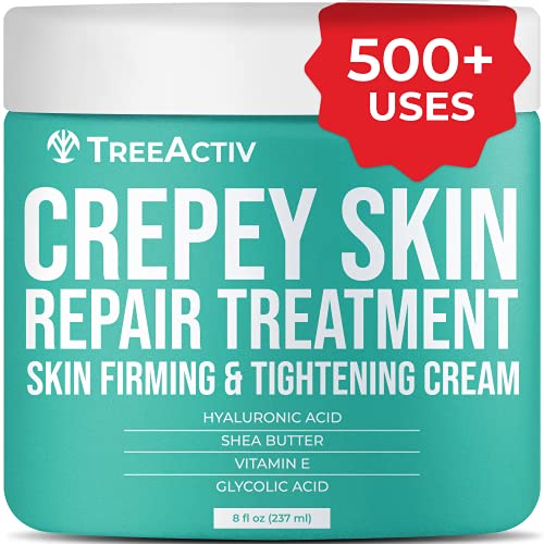 TreeActiv Crepey Skin Repair Treatment | Hyaluronic Acid Skin Firming & Tightening Lotion for Sagging Neck, Arms, Chest, & Legs | Anti-Aging & Anti-Wrinkle Cream & Stretch Marks Remover | 500+ Uses
