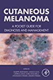 Cutaneous Melanoma: A Pocket Guide for Diagnosis and Management