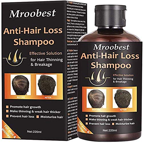 Book Cover Anti-Hair Loss Shampoo, Hair Regrowth Shampoo, Natural Old Ginger Hair Care Shampoo Effective Solution for Hair Thinning & Breakage - Organic Hair Regrowth.Products for Men & Women