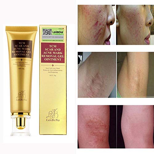 Scar and Acne Spots Mark Removal Gel Cream Face Care Acne Treatment Whitening Moisturizing Facial Cream 30ml