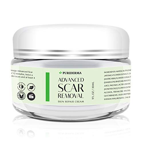 Scar Removal Cream - Advanced Treatment for Face & Body, Old & New Scars from Cuts, Stretch Marks, C-Sections & Surgeries - With Natural Herbal Extracts Formula - (30 ml)
