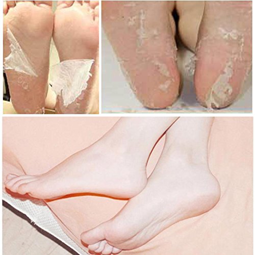 Kizaen 10 Packs Exfoliating Foot Peel Mask - Exfoliant for Soft Feet in 1-2 Weeks, Peeling Off Calluses & Dead Skin, For Men & Women (1 Pairs Per Pack)