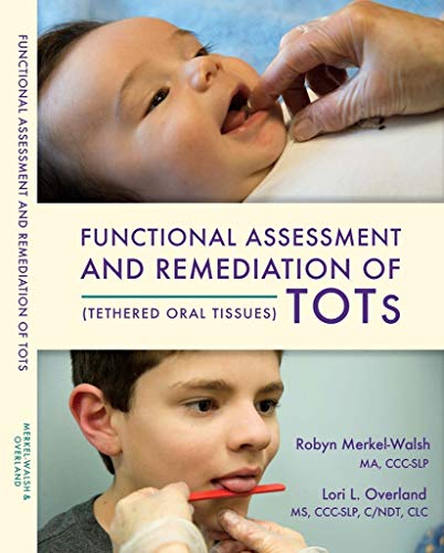 Book Cover Tongue-Tied: Functional Assessment and Remediation of TOTs (Tethered Oral Tissues)