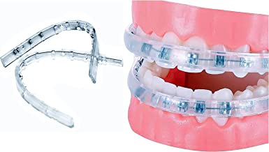 TecnidentUSA Clip-On Comfort Lip Shield/Mouth Protector Guard For Braces - Orthodontic Dental Wax Alternative - 2019 New and Improved