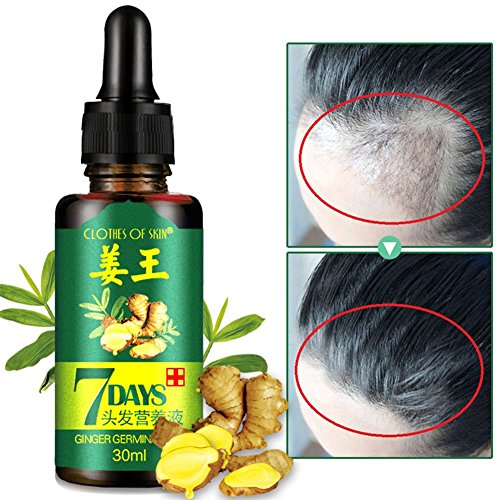 Ginger Germinal Oil,2020 Hair Growth Ginger Essential Oil Hair Growth Hair Loss Treatment Hair Growth Serum for Men and Women