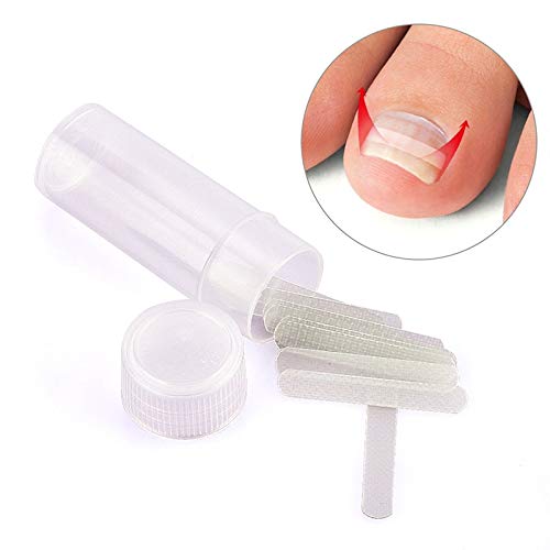 Ingrown Toenail - 10 Pcs Ingrown Toenail Pedicure Tool Elastic Patch Straightening Clip Curved Brace Toenails Thick Paronychia Correction Tool