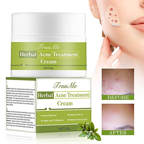 Acne Treatment, Acne Removal, Pimple Cream, Advanced Anti Acne Cream, Remove Acne, Repair Acne Natural/Quickly
