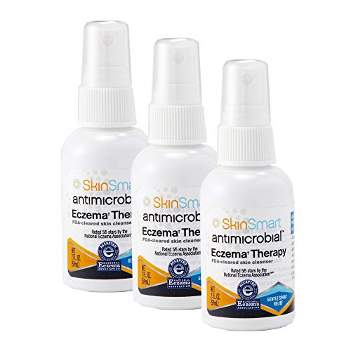 SkinSmart Eczema Therapy, Hypochlorous Antimicrobial Safely Removes Bacteria, so Your Skin Can Heal, Travel Size 2 Ounce Spray (Pack of 3)