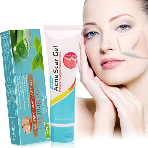 Acne Scar Remover, Acne scar treatment, Scar Removal, Scar Gel, Scar Remover Gel for Face Body, Old & New Scars from Cuts, Stretch Marks, C-Sections & Surgeries, Natural & Gentle
